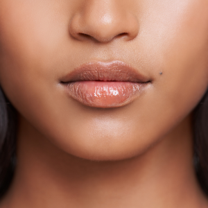 Lip Volume & Definition
