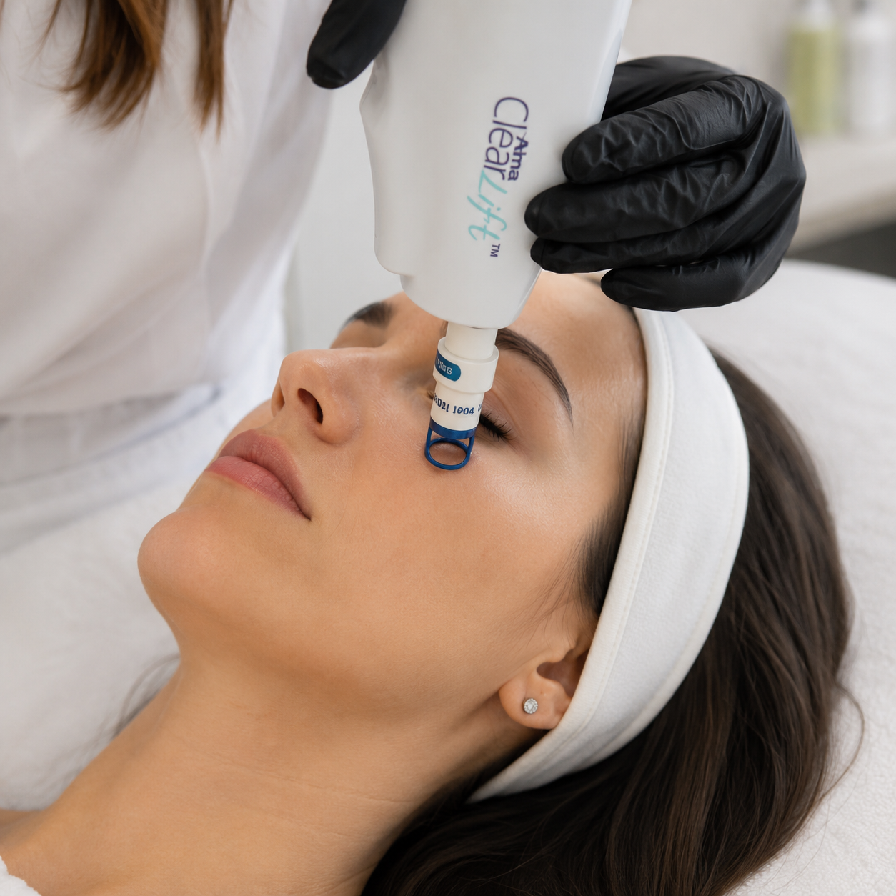 ClearLift laser treatment for the delicate under-eye area