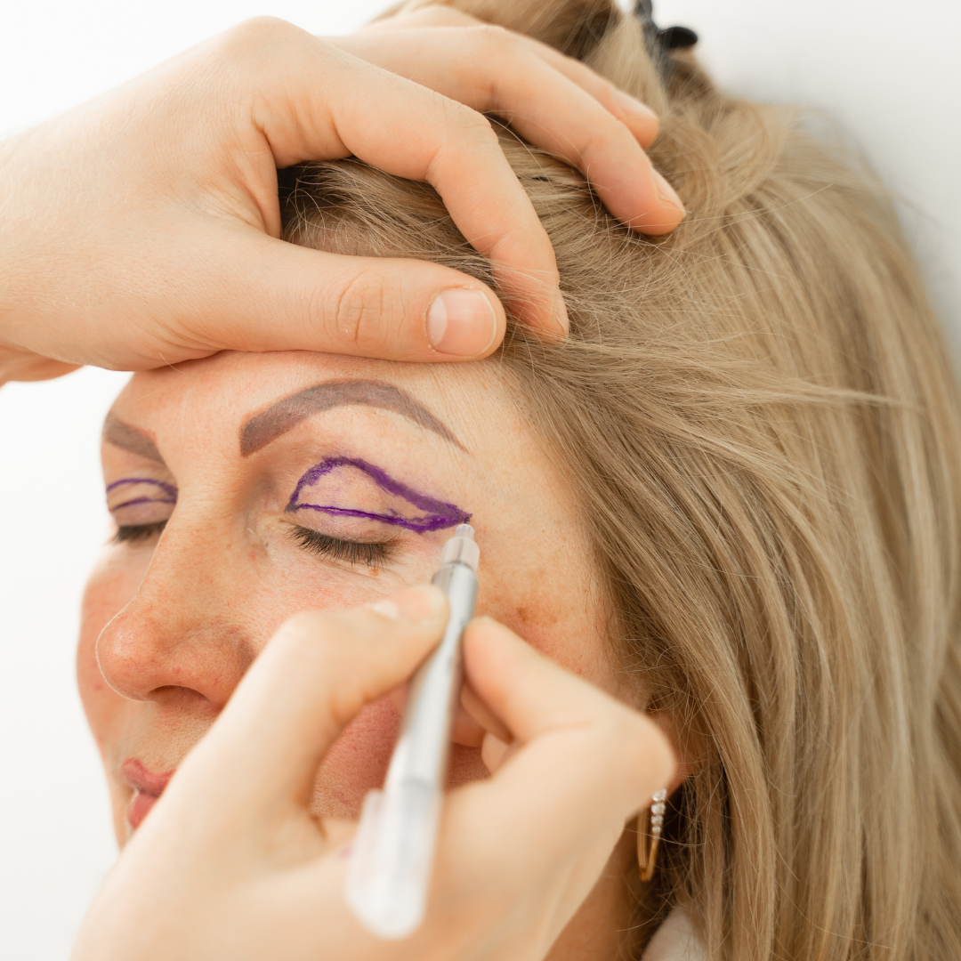 Felső szemhéjplasztika – EA Beauty Medical