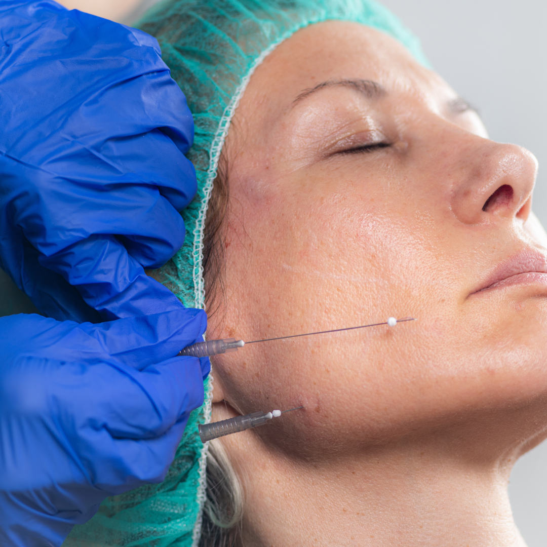 Bioszálas Arckontúr – EA Beauty Medical
