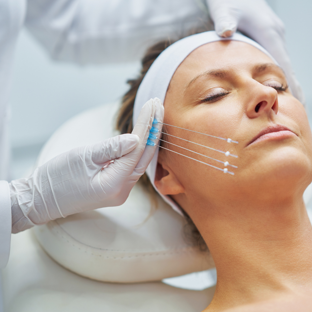 Fullface Arcformázás Bioszálakkal és HA – EA Beauty Medical
