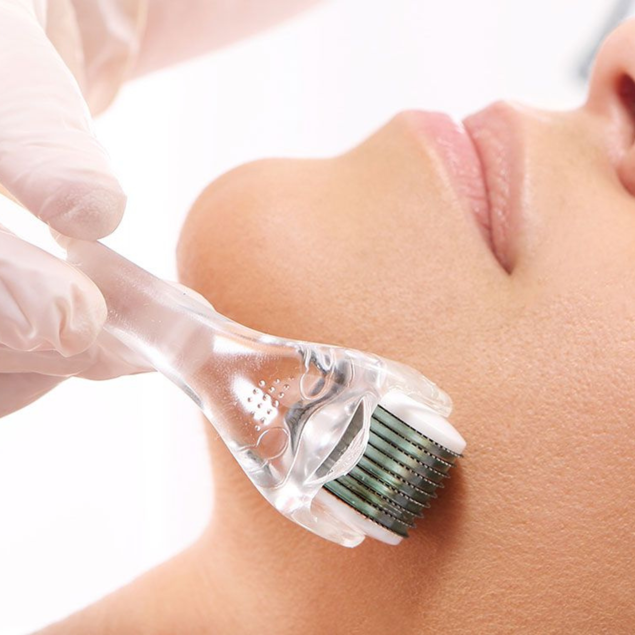 Mesobotox képzés – EA Beauty Medical Academy