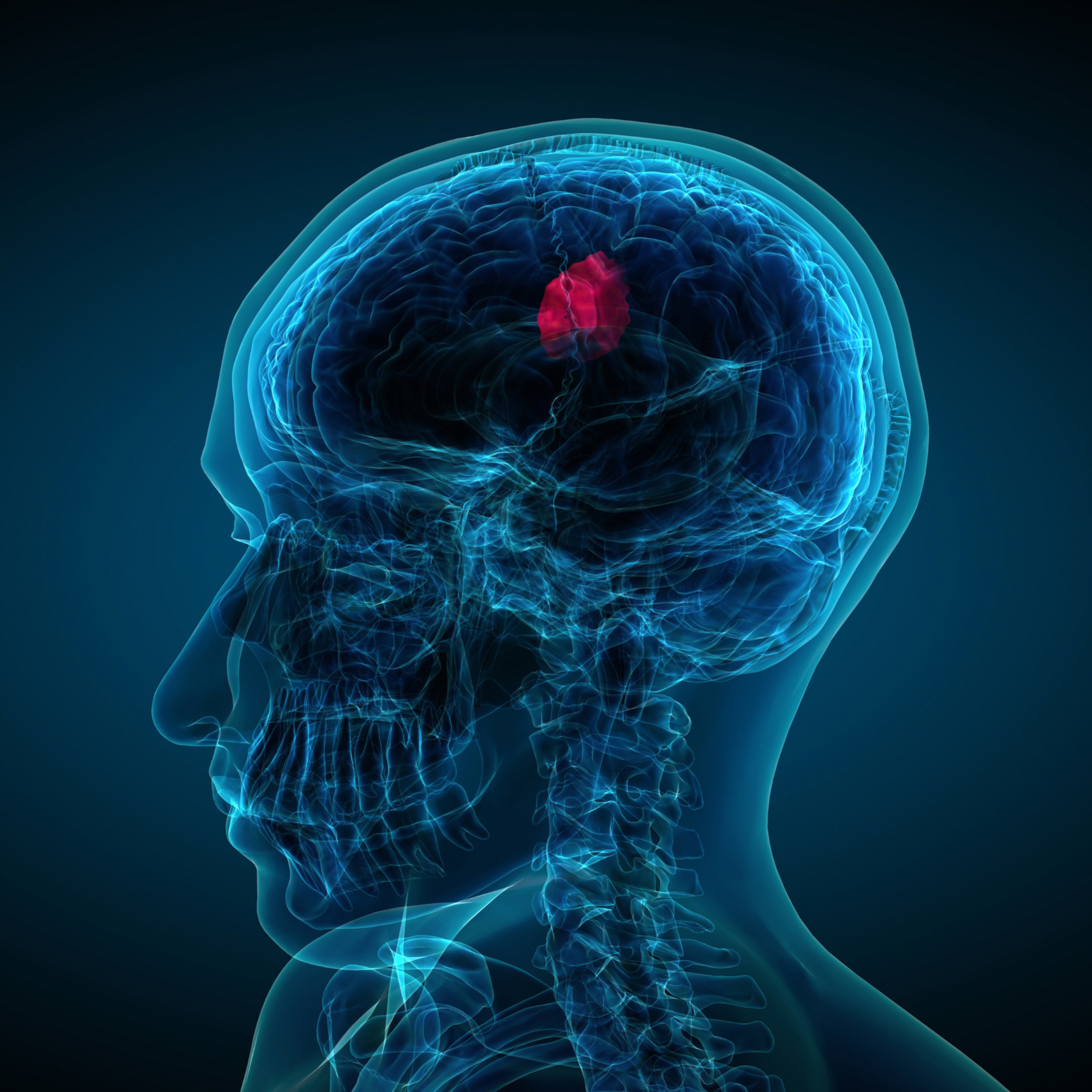 Férfi tumor panel laborcsomag