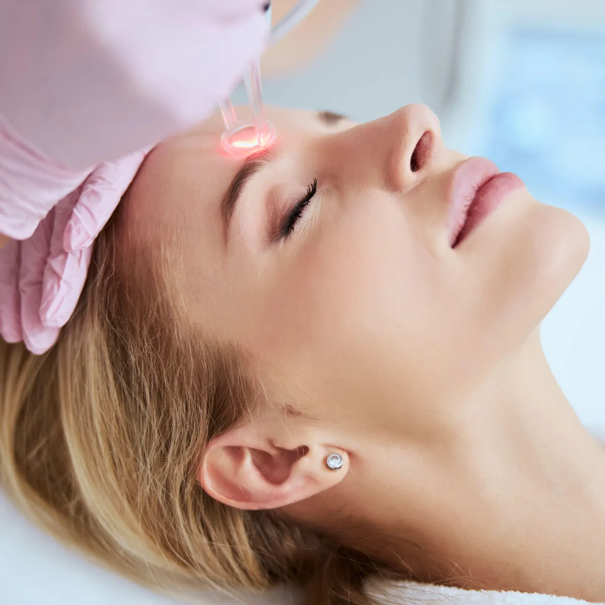 CO2 lézeres kezelések