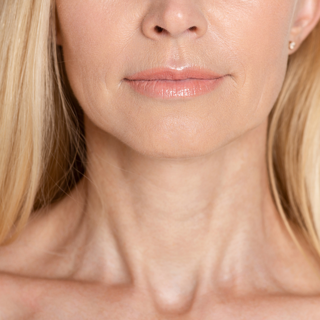 Nyaki Mesobotox – EA Beauty Medical