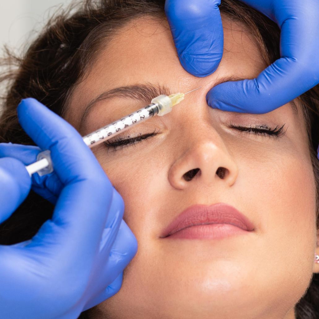 Fullface Botox – EA Beauty Medical