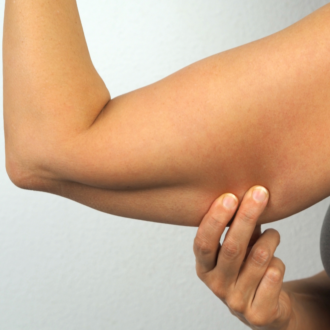 Felkarplasztika – tájékoztató kép – EA Beauty Medical