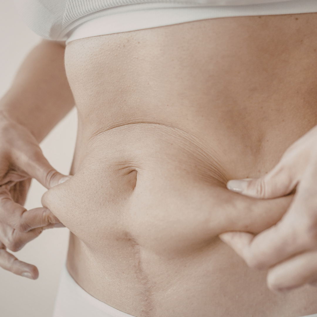 Felsőtestplasztika (Upper Body Lift)