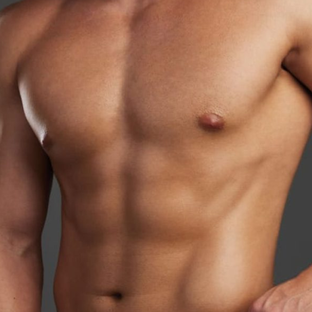 Férfi mellplasztika (Gynecomastia)