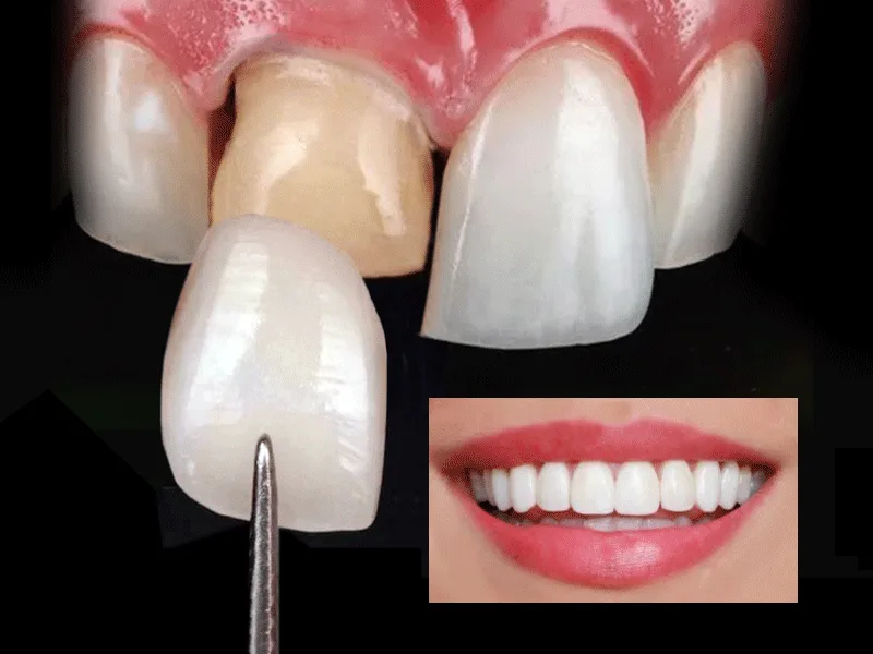 Odontología estética