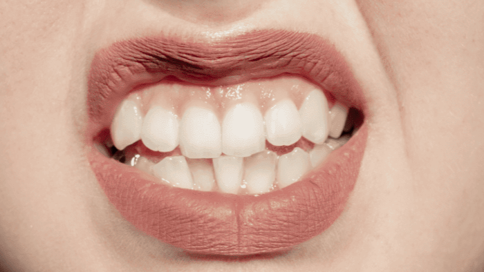 Tus dientes se han ido moviendo con el tiempo