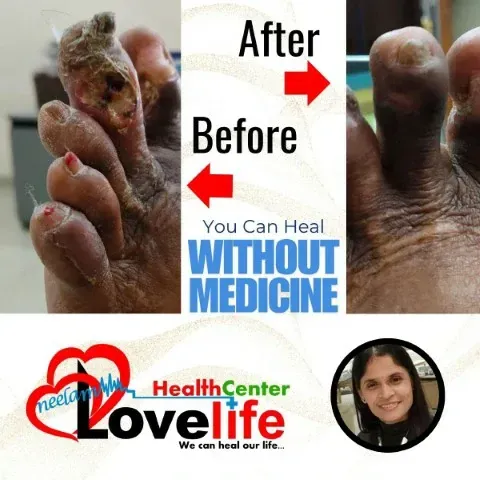 Transformation Original 4