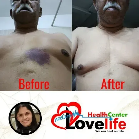 Transformation Original 3