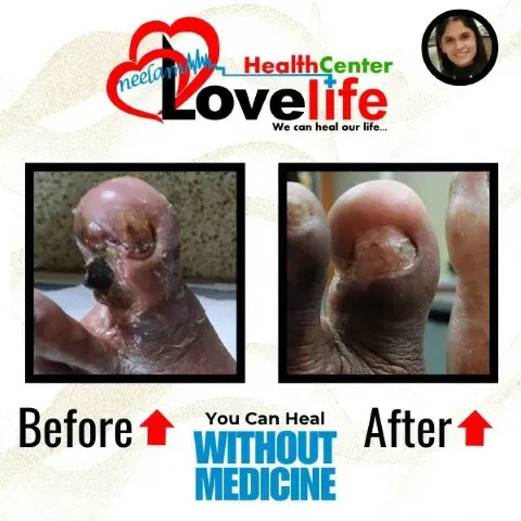 Transformation Original 2