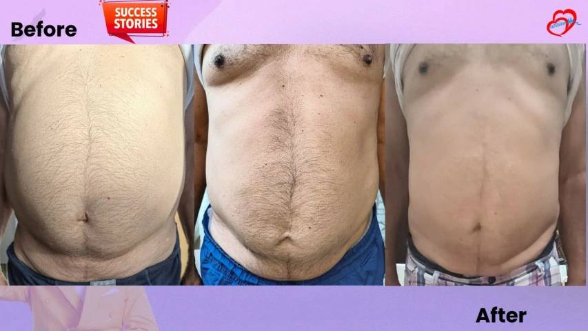 Patient Transformation 35