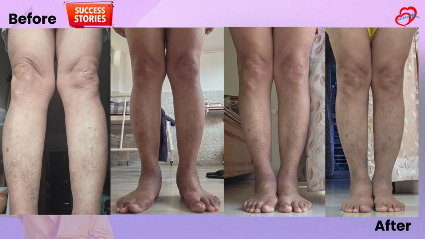 Patient Transformation 38