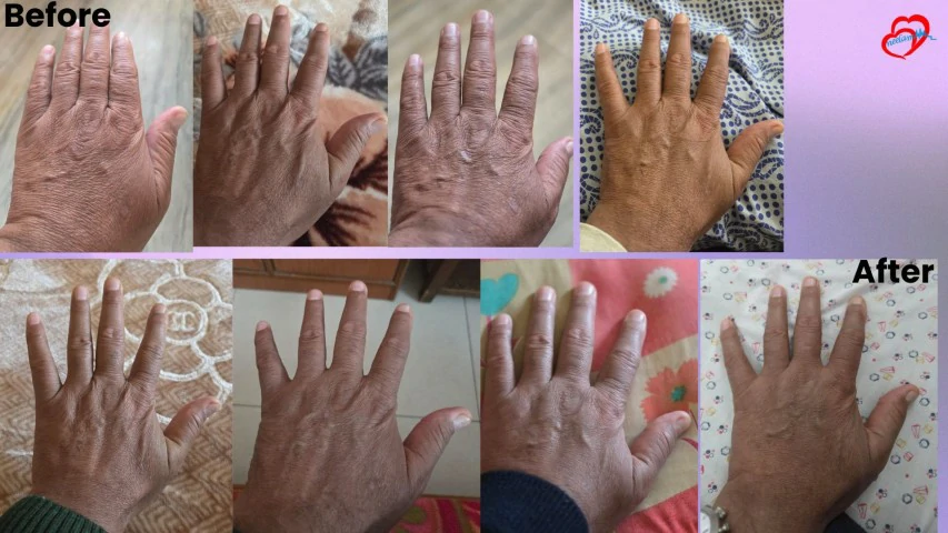Patient Transformation 34
