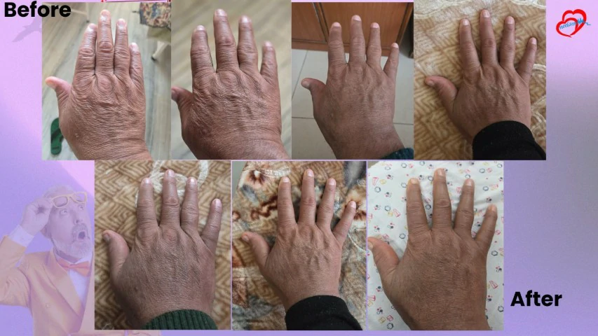 Patient Transformation 33