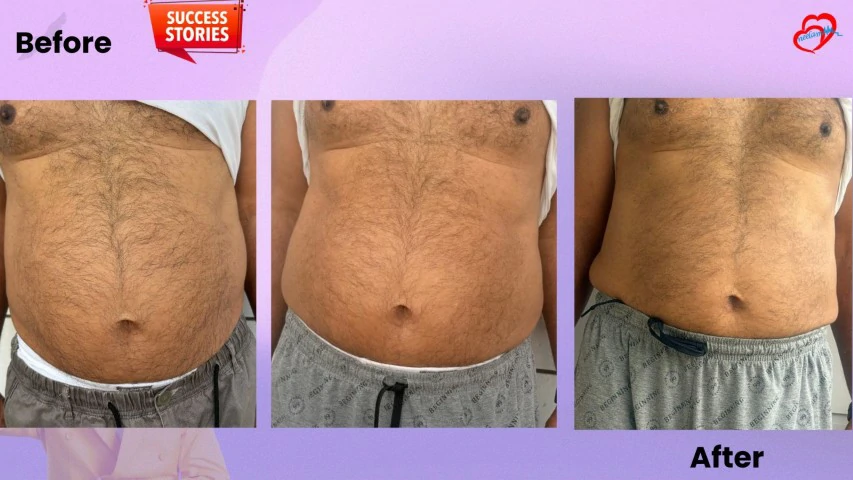 Patient Transformation 37