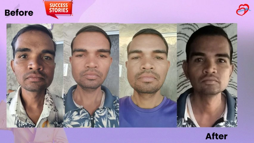 Patient Transformation 32