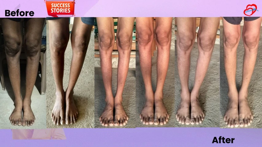 Patient Transformation 30