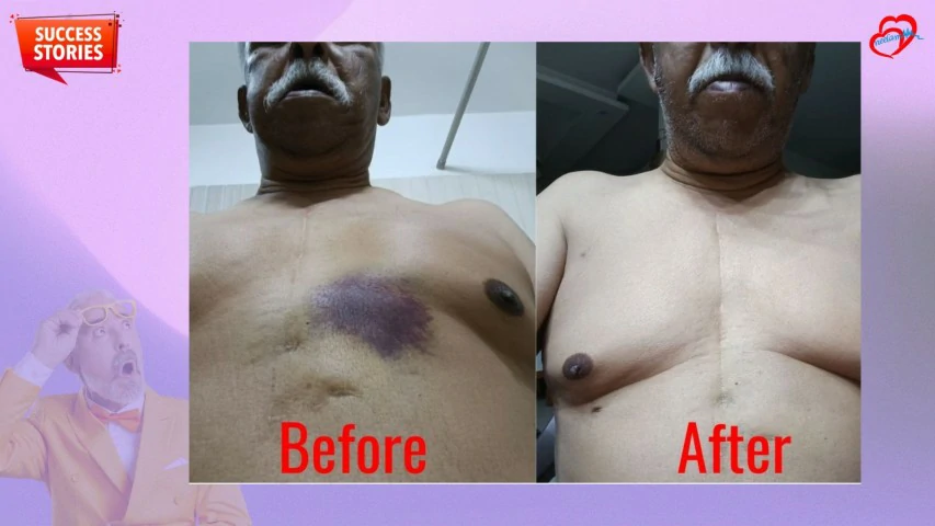 Patient Transformation 27