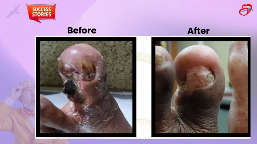 Patient Transformation 28
