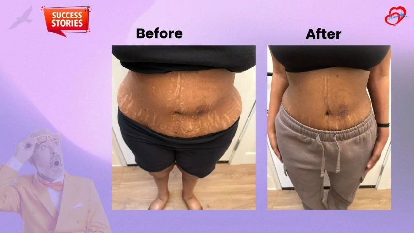Patient Transformation 29