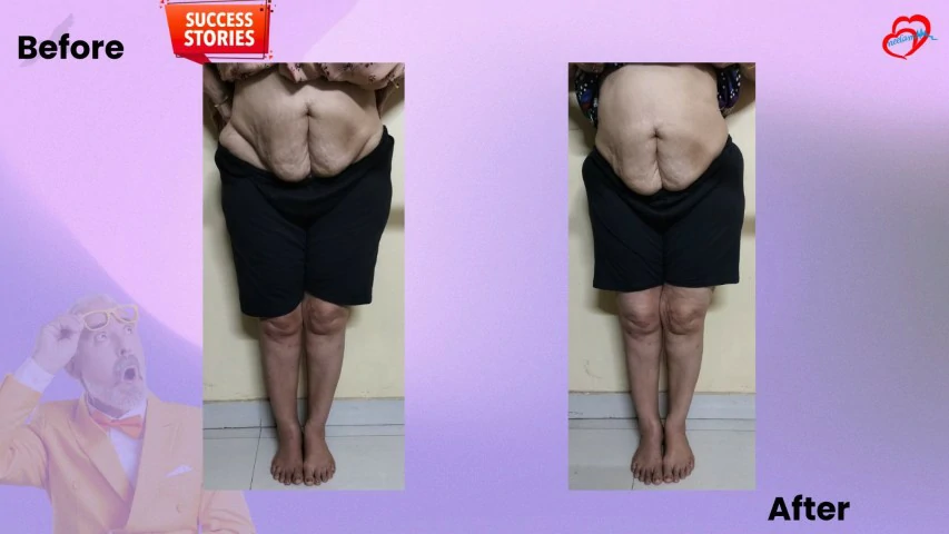 Patient Transformation 31
