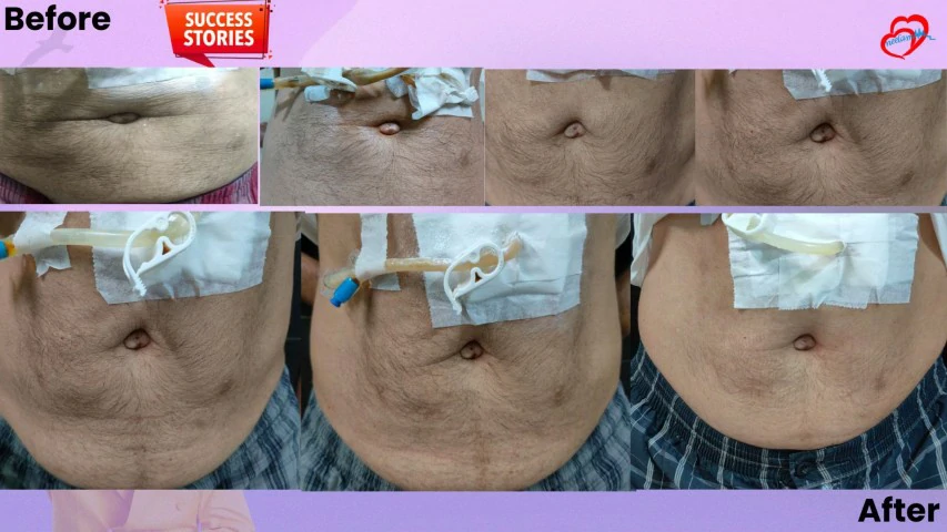 Patient Transformation 21