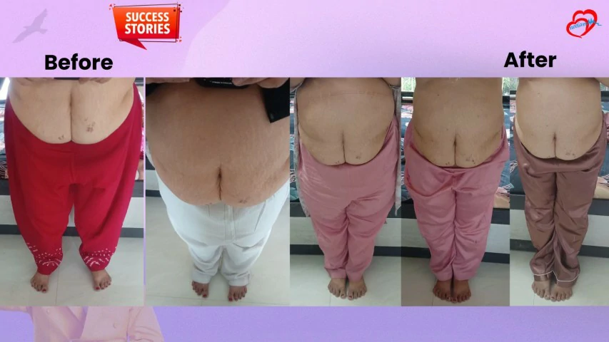 Patient Transformation 23