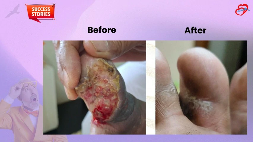Patient Transformation 25