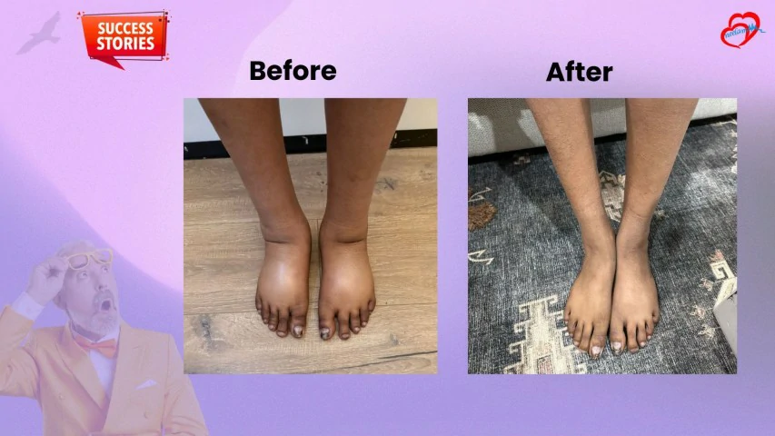 Patient Transformation 22