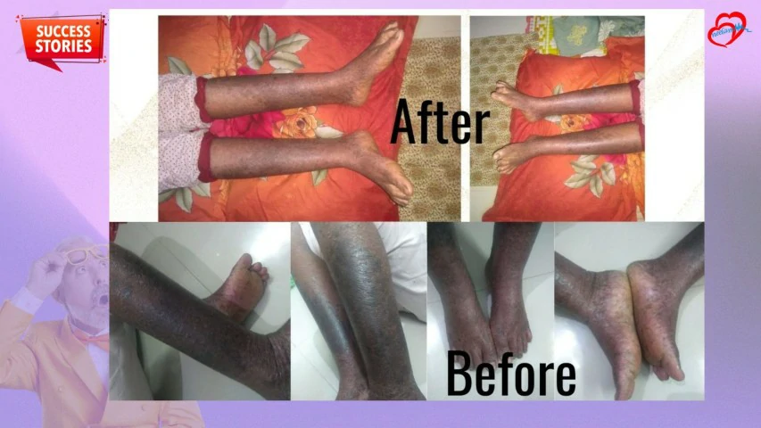 Patient Transformation 20