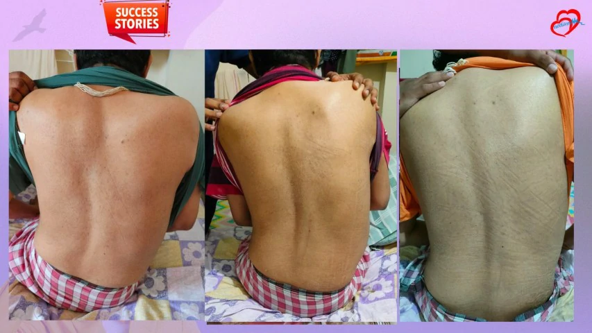 Patient Transformation 15