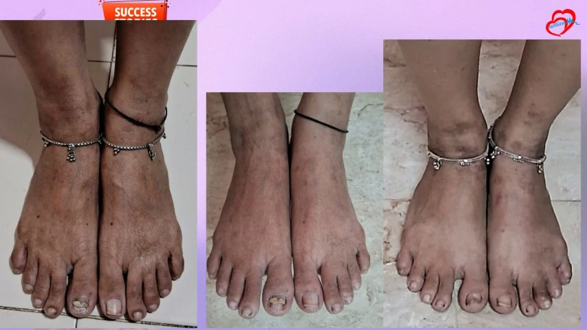 Patient Transformation 14