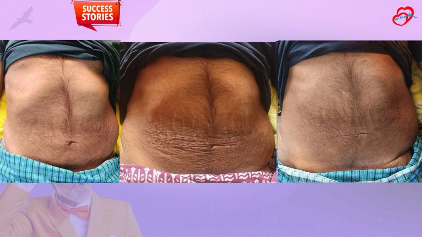 Patient Transformation 12