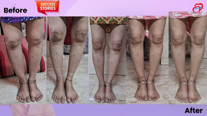 Patient Transformation 13