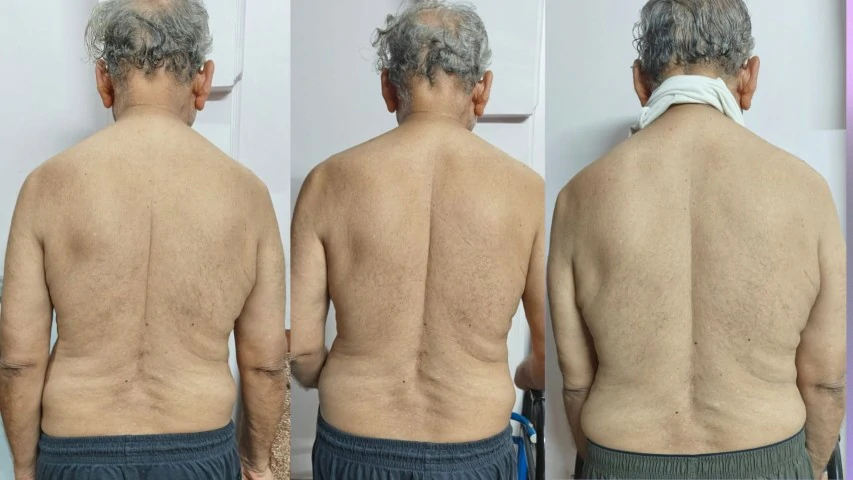 Patient Transformation 10
