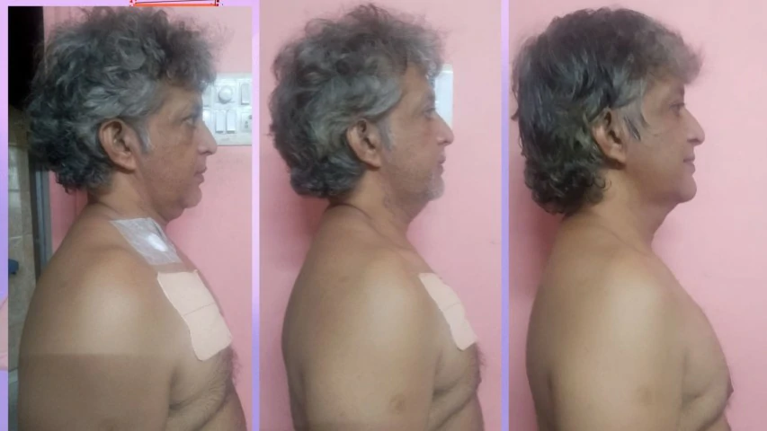 Patient Transformation 8