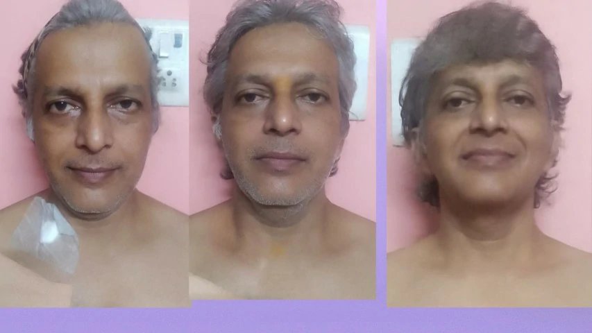 Patient Transformation 6
