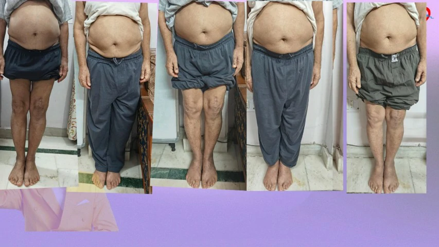 Patient Transformation 7