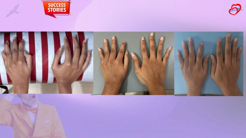 Patient Transformation 3