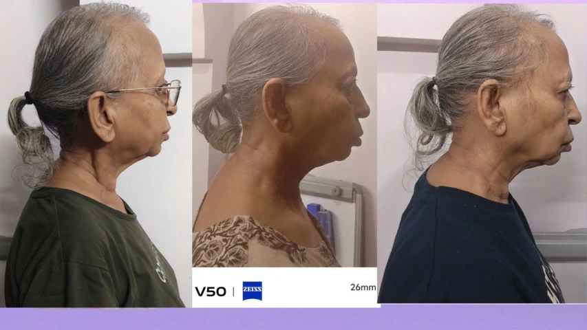 Patient Transformation 5