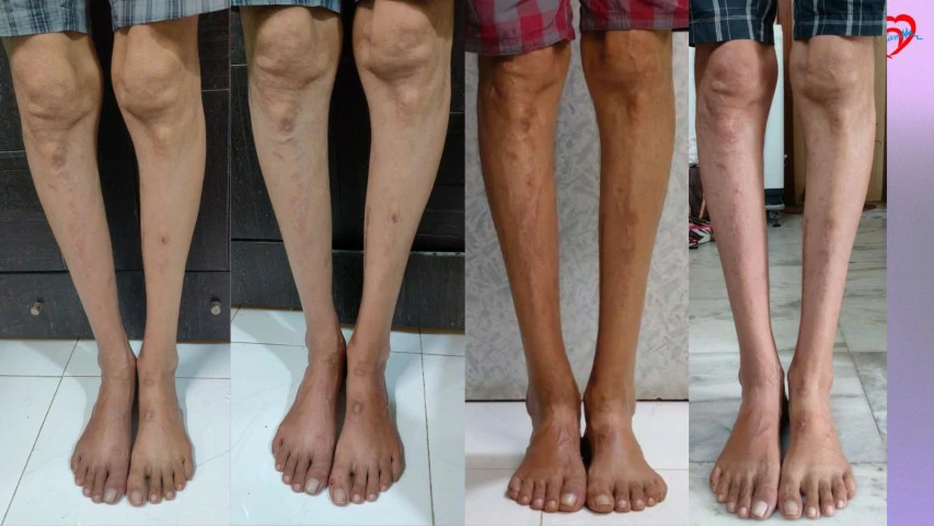 Patient Transformation 1