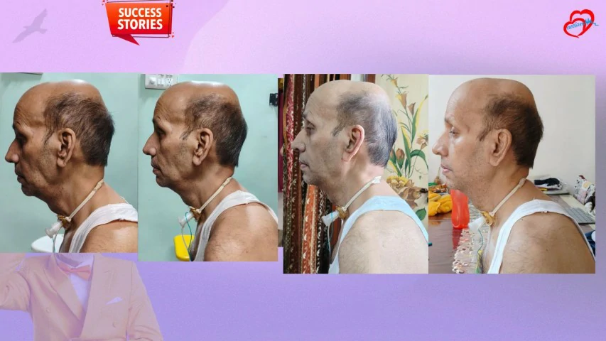 Patient Transformation 2