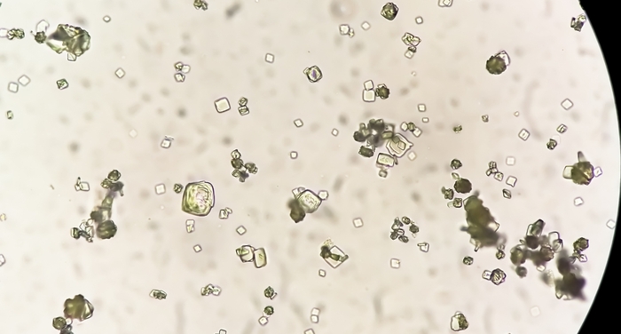 Oxalates Under a Microscope