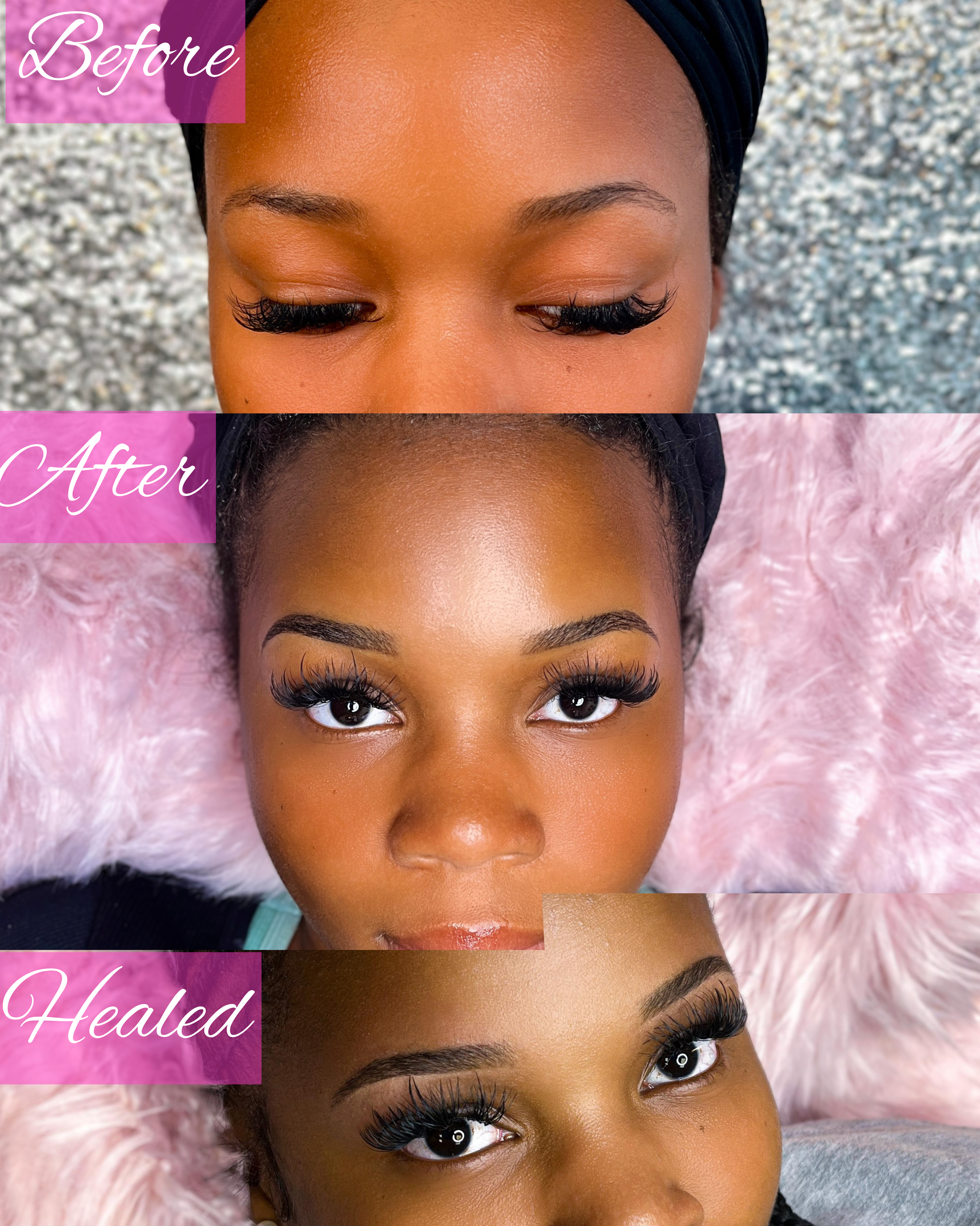 Brow struggle