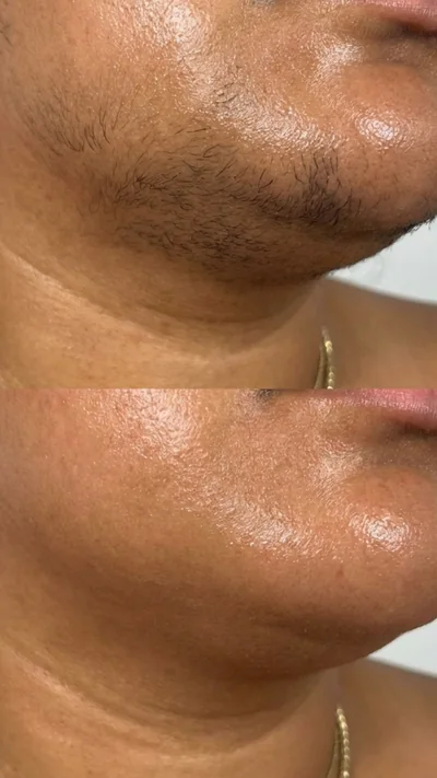 Facial waxing before-and-after results by Makeup By Mary LLC