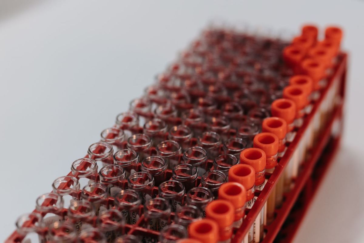 Blood sample tubes in a laboratory rack